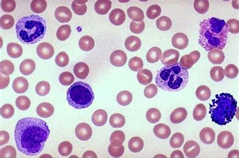 How To Identify Normal Leukocytes In A Blood Smear Pathology Student