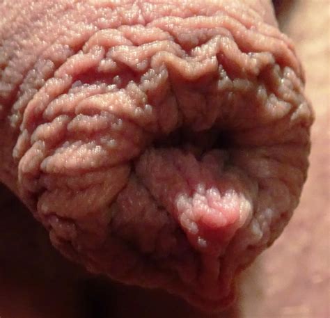 My Cock With Foreskin 18 Pics Xhamster