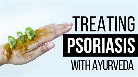 Very Effective Psoriasis Treatment In Ayurveda Dr Pratap Chauhan