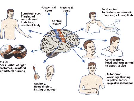 Types Of Seizures Types Of Everything