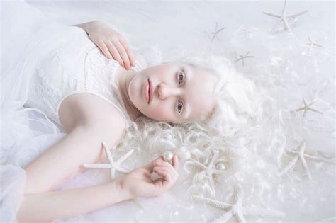 These Photos Perfectly Capture The Beauty Of People With Albinism