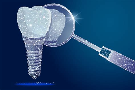 It is normal to feel some pain after the anesthesia wears off. How Long Does it Take to Get Dental Implants? | Cosmetic ...