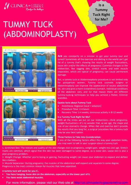 Tummy Tuck Abdominoplasty Pdf