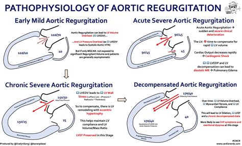 Aortic Regurgitation Pathophysiology Early Mild Grepmed