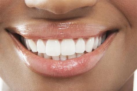 porcelain veneers in midtown nyc achieve your dream smile