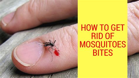 How To Get Rid Of Mosquitoes Bites Treating Mosquito Bites With Home Remedies Youtube