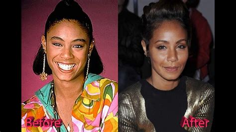 Jada Pinkett Smith Plastic Surgery Before And After Photos Youtube