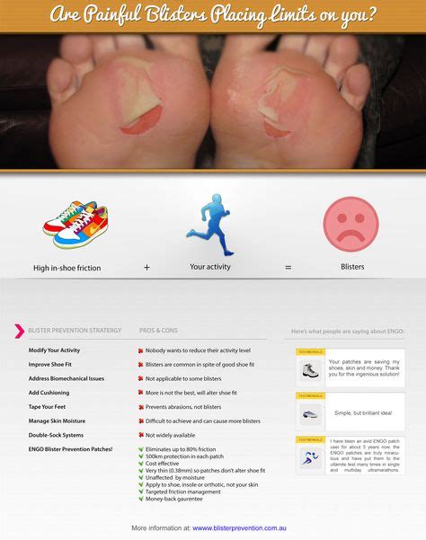 26 Best Blister Prevention Infographics Images In 2017 Info Graphics