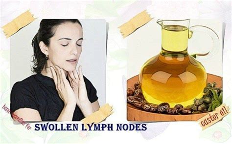 21 Natural Home Remedies For Swollen Lymph Nodes In Neck And More In 2020