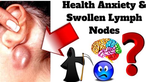 Symptoms Of Swollen Lymph Nodes Youtube