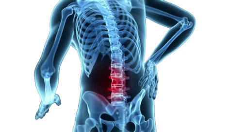 Should You See A Chiropractor For Low Back Pain Back Pain Chiropractic