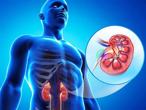 Alimenti consentiti con moderazione per calcoli di ossalato di calcio sale. 6 alimenti che possono causare calcoli renali - Tecnologia ...