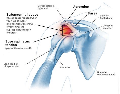 Shoulder Impingement Syndrome The Institute For Athletic 55 Off