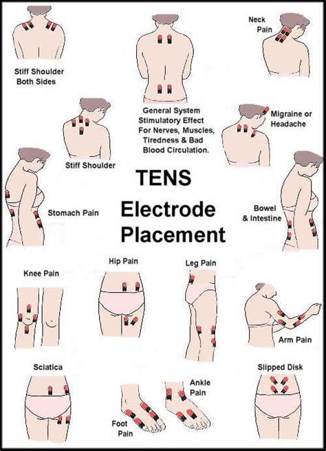 Top online supplier · free electrodes with tens TENS Unit Electrode Placement Guide ...