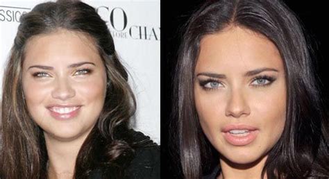 Adriana Lima Plastic Surgery Before And After Photo