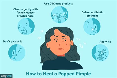 How To Heal A Popped Pimple Scab Meopari