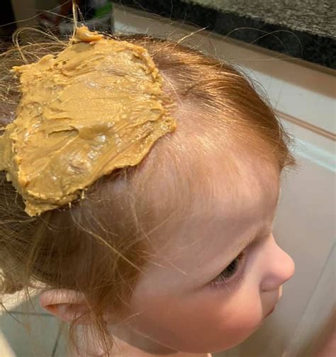 Mum Removes Gross Chewing Gum Matted In Her Daughters Hair Using