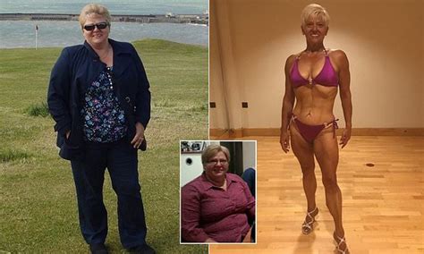 Dna Profiling Helped Size Woman Shift Half Her Body Weight