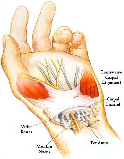 (1) the collagen fibers are closely packed (dense) and leave relatively little open space, and (2) the fibers are. Carpal Tunnel Syndrome - Drwolgin