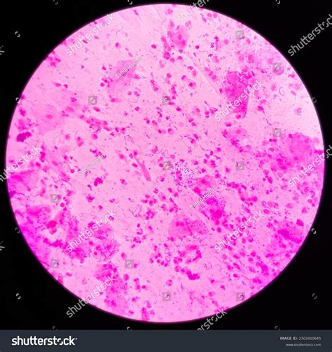 Sputum Gram Stain Microscopic View Show Stock Photo 2102410645