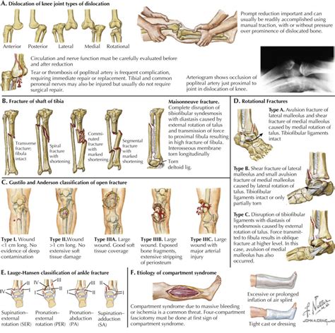 Acute Fractures And Dislocations In Athletes Musculoskeletal Key