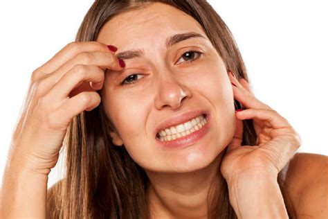 Dry Flaky Skin Dandruff Between Eyebrows Causes Home Remedies