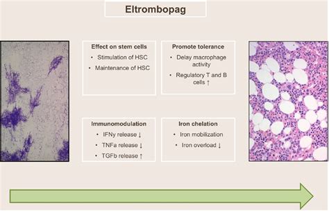 Figure 1 From Current Evidence And The Emerging Role Of Eltrombopag In
