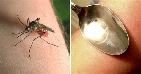 10 Ways To Save Yourself From The Annoyingly Itchy Mosquito Bites