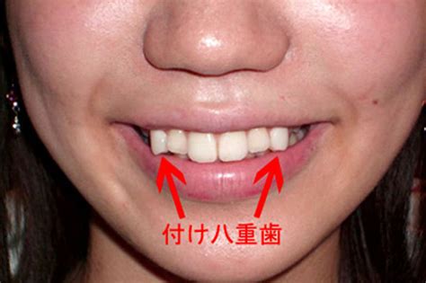 Crooked Teeth The Hot New Beauty Trend In Japan HuffPost Life