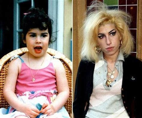 Antes E Depois Cantora Amy Winehouse