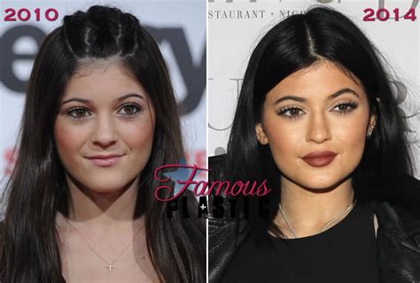 Kylie Jenner Fake Beauty Regiment Glorified Why Doesnt She Admit