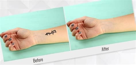 Dry removal of saniderm may cause discomfort and added trauma to the skin. How to Remove a Tattoo in Photoshop