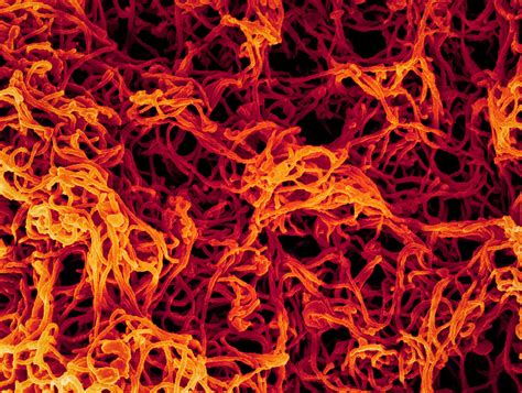Ebola Virus Scanning Electron Micrograph Of Filamentous Eb Flickr