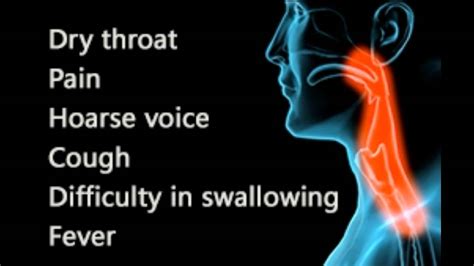 Throat Infection Symptoms Youtube