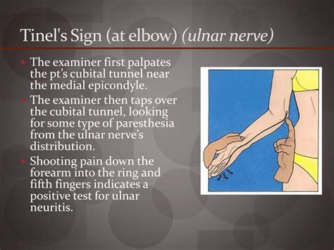 Ppt Elbow Evaluation Powerpoint Presentation Free Download Id2188562
