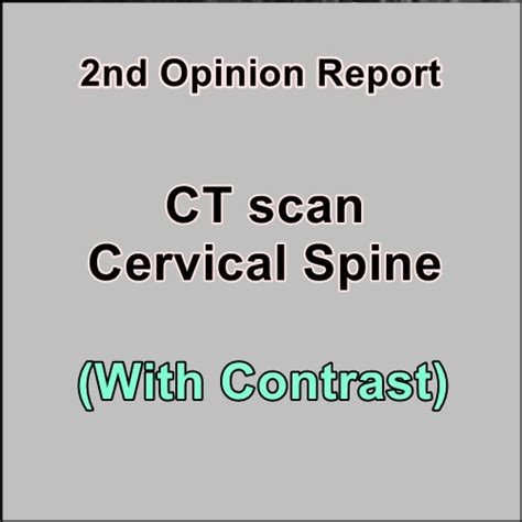 Ct Scan C Spine With Contrast Target Radiology