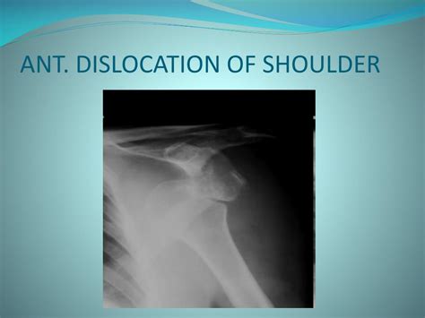 Ppt Signs In Radiology Powerpoint Presentation Id510632