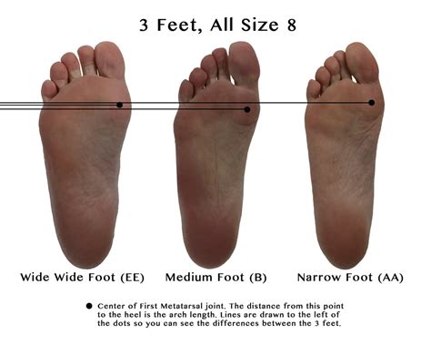 Recommendations For Someone Who Has Hammer Toes Rbballshoes