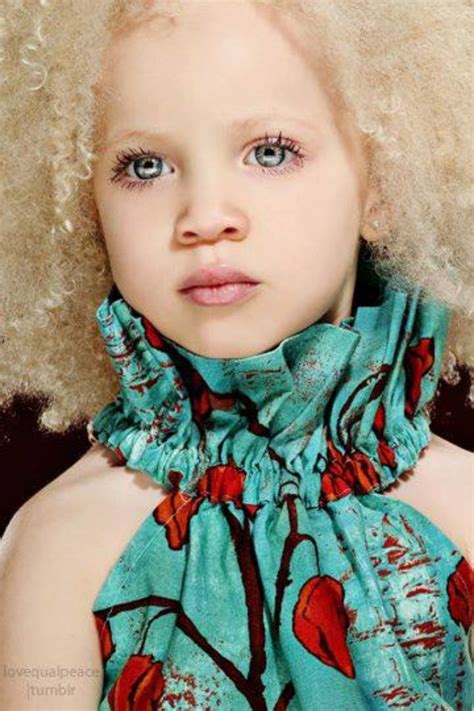 Beautiful African Albino Child My Black Is Beautiful Beautiful