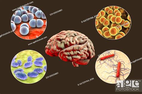 Etiology Of Bacterial Meningitis 3d Illustration Neisseria