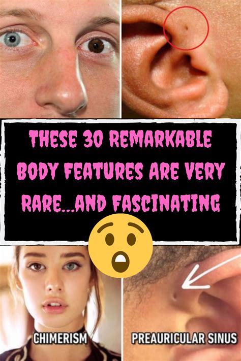 These 30 Remarkable Body Features Are Very Rareand Fascinating Humor