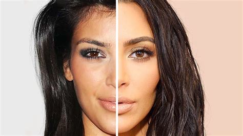 Kim Kardashian Before And After Plastic Surgery Youtube