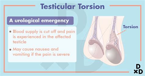 8 Causes Of Testicular Pain Explained By A Urologist