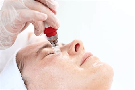 The Different Types Of Facial Treatments April 2024 Ellemes Medical Spa