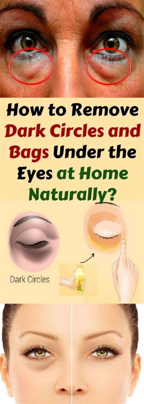 How To Remove Dark Circles Bags Under The Eyes At Home Naturally Remove Dark Circles