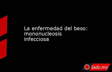 La Enfermedad Del Beso Mononucleosis Infecciosa Ladomx