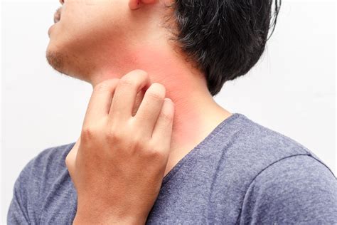 Itchy skin at night, called nocturnal pruritus, can be severe enough to disrupt sleep regularly. 12 Conditions Your Itchy Skin May Be Trying to Alert You To