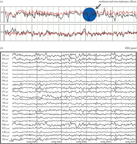 A Illustration Of The Eeg Data Contaminated With Nonlinear Andor Download Scientific Diagram