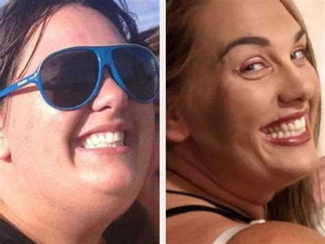 Auckland Womans Incredible 80kg Weight Loss Herald Sun