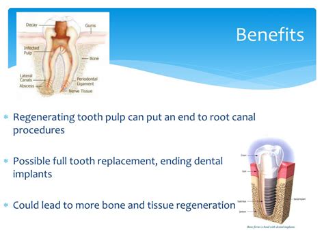 Ppt Tooth Regeneration Powerpoint Presentation Free Download Id